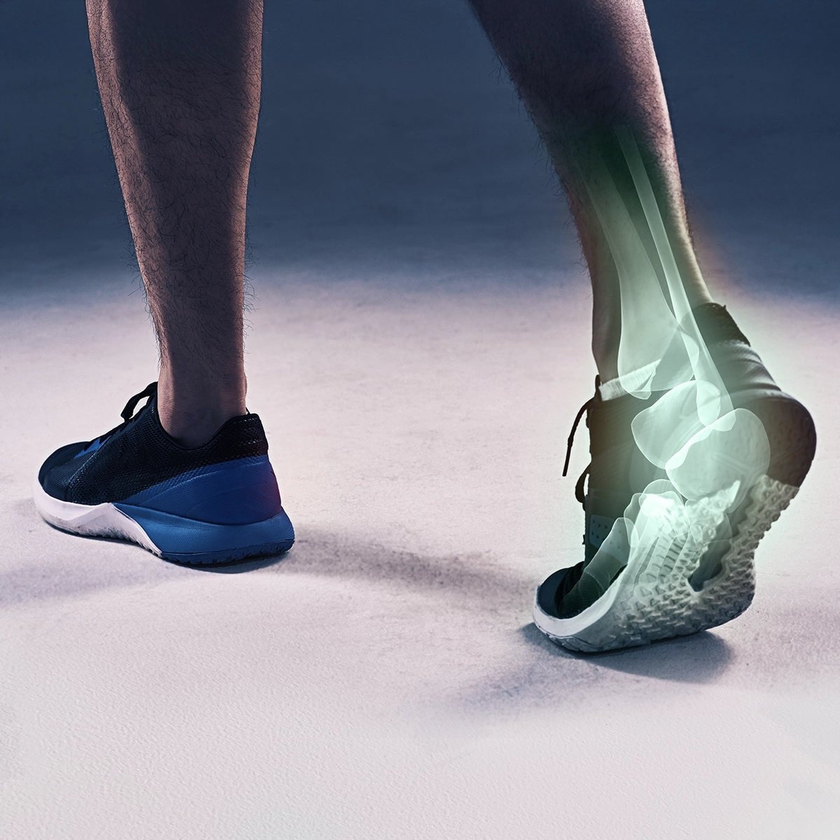 MagnaStep™ Magnetic Acupressure Insoles - Komforten