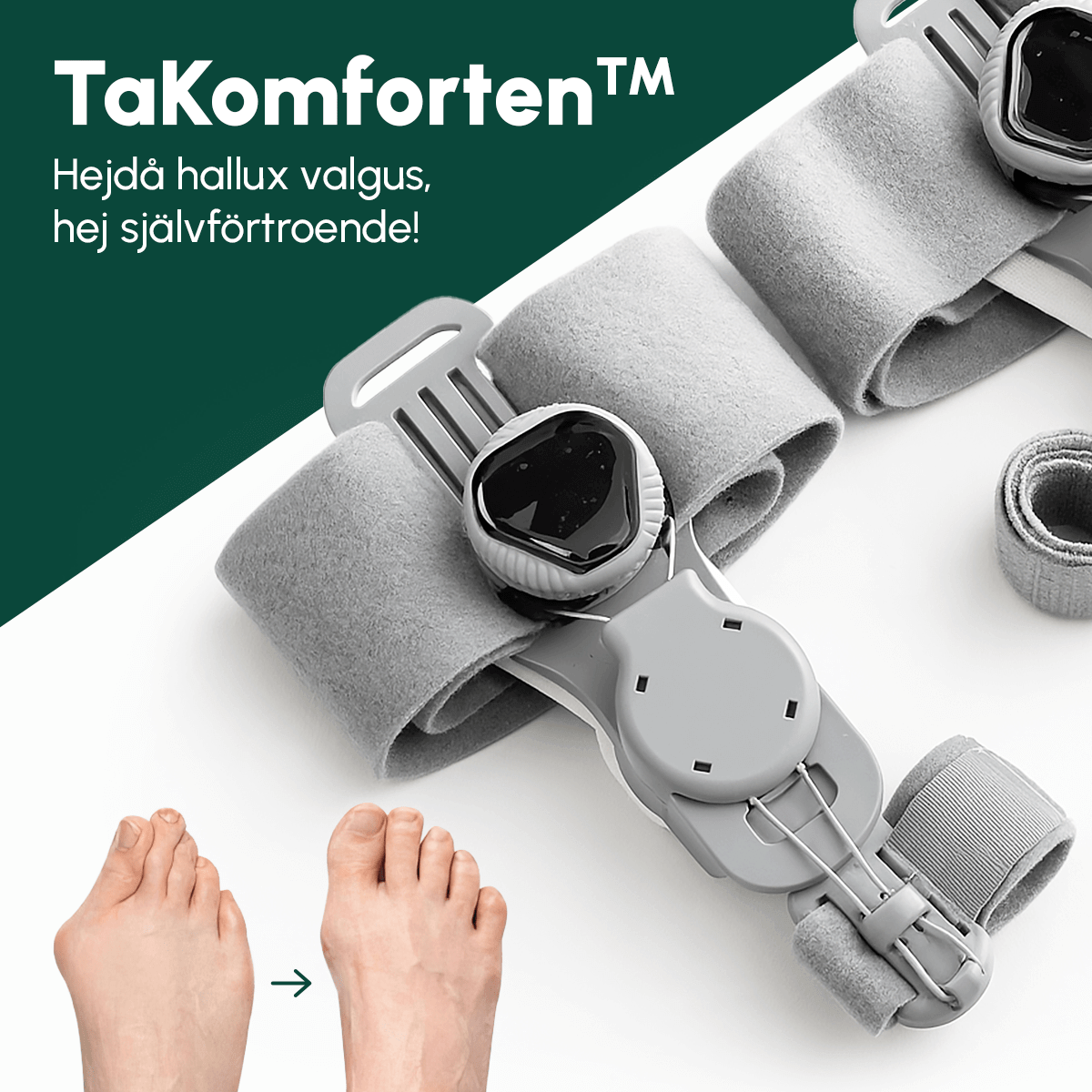 Takomforten™ Bunion Corrector – Korrigering av Hallux Valgus - Komforten